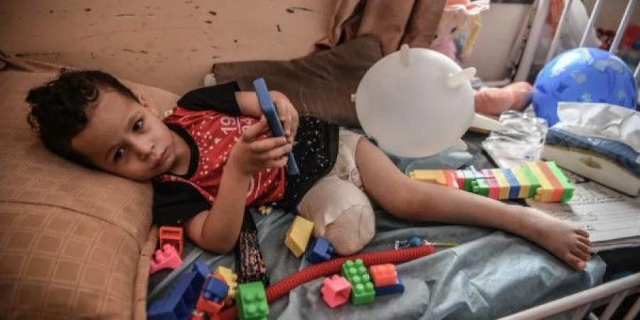 غزة تسجّل أعلى معدل لبتر الأطراف لدى الأطفال نسبةً لعدد السكان عالمياً