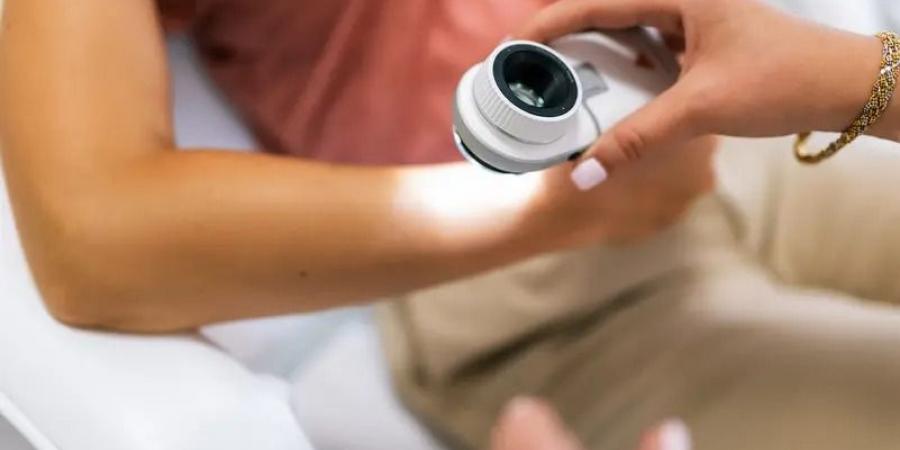 اكتشاف علمي هام.. "بروتين خفي" يقود سرطان الجلد ويعطل المناعة