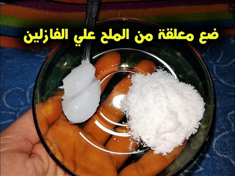 في دقائق معدودة .. وصفة الفازلين والملح الرهيبة لإزالة شعر الجسم كله
